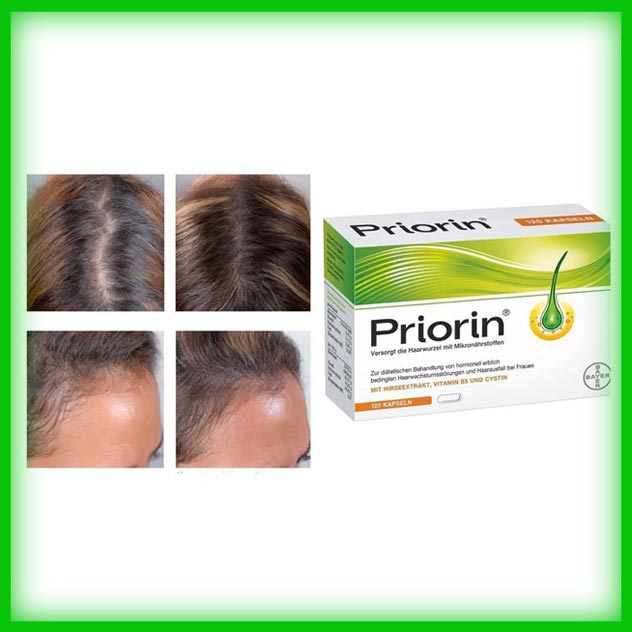 قرص پریورین بایر چه فوایدی دارد؟