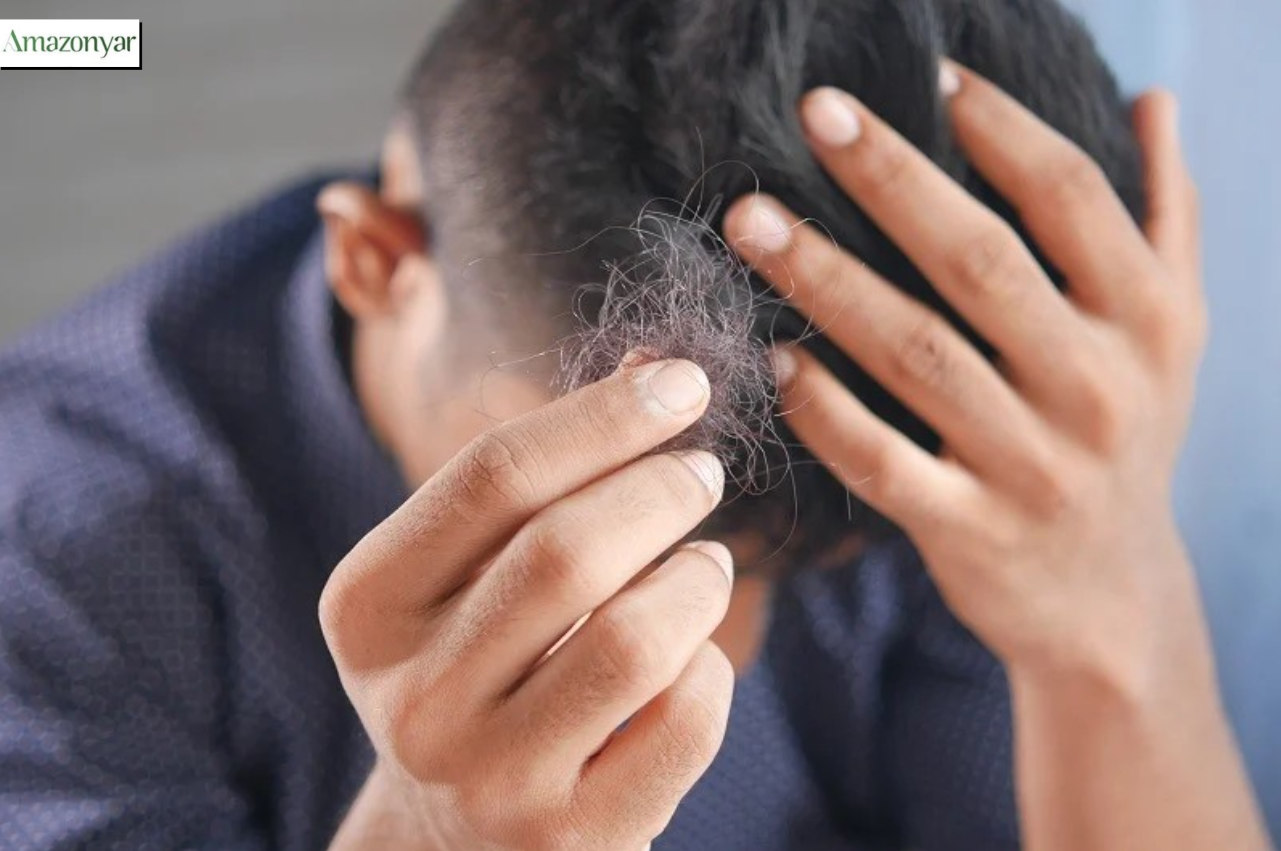 قرص نخل اره ای برای ریزش مو