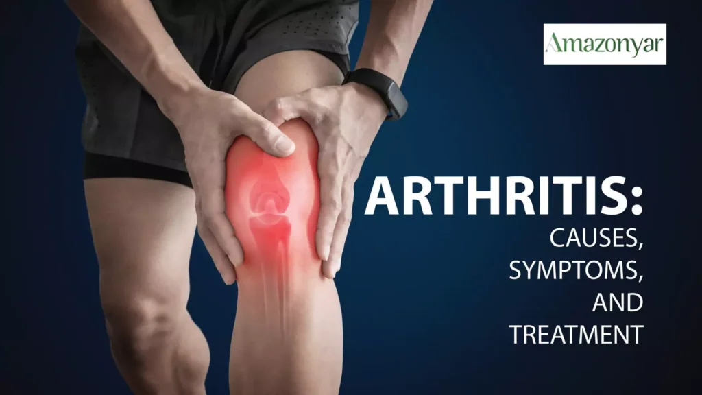 مکمل های موثر در درمان آرتریت|خداحافظی با دردهای مفصلی