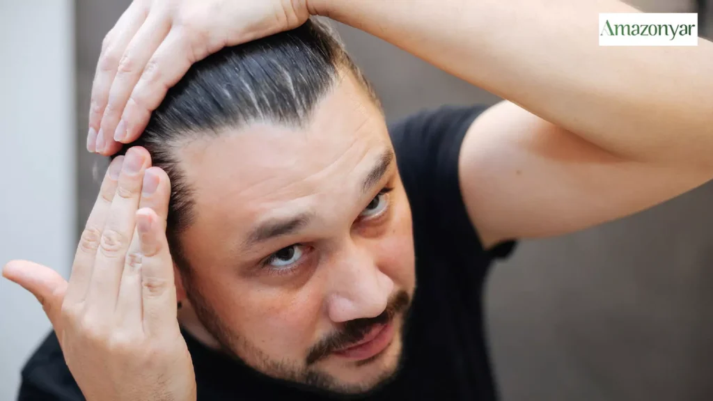 بهترین گیاه دارویی برای ریزش موی مردان